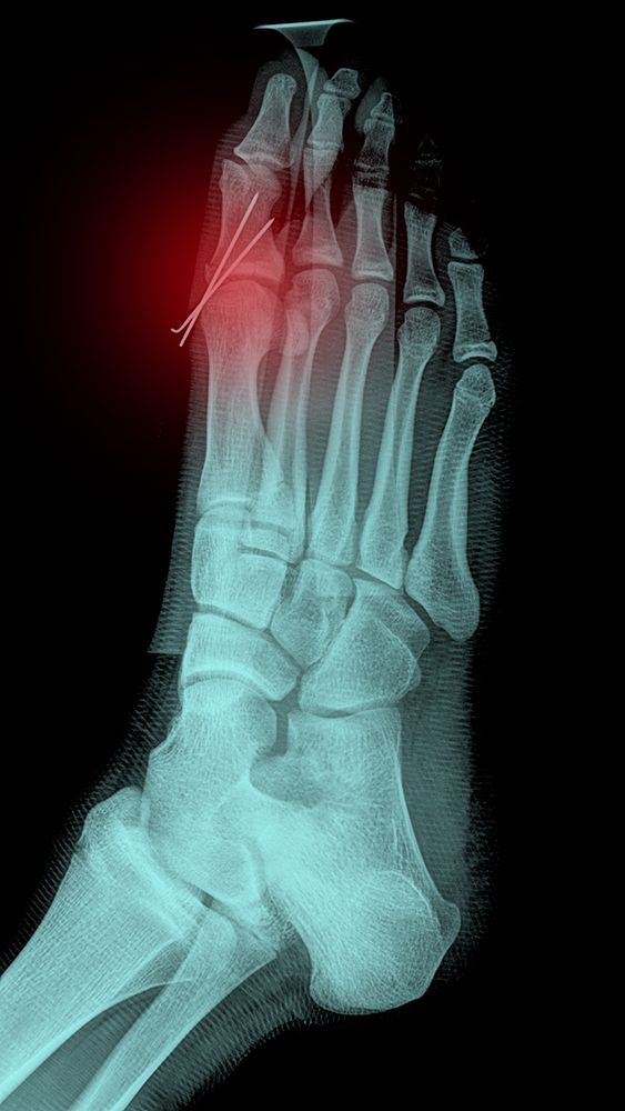 Digital X-Rays