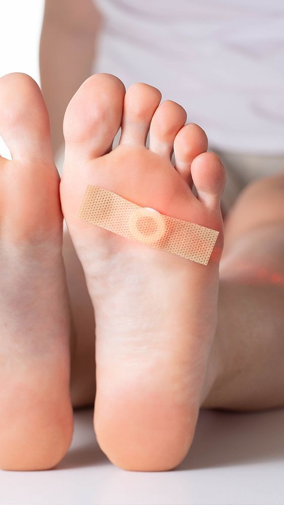 Swift Wart Therapy