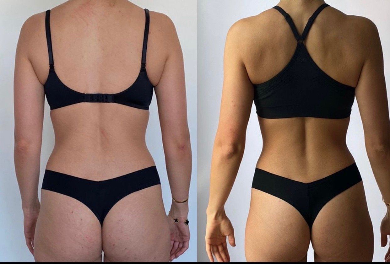 A before and after picture of a woman 's back