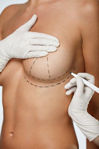 Orlando Breast Augmentation Procedures Plastic Surgery Central