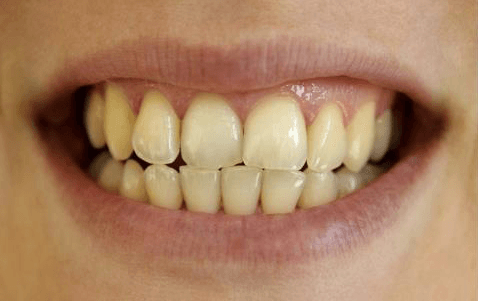 Trattamento dentale