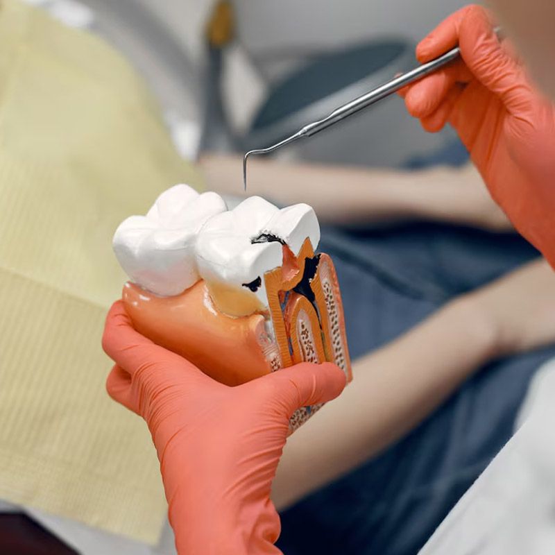 Permanent alternative to dentures