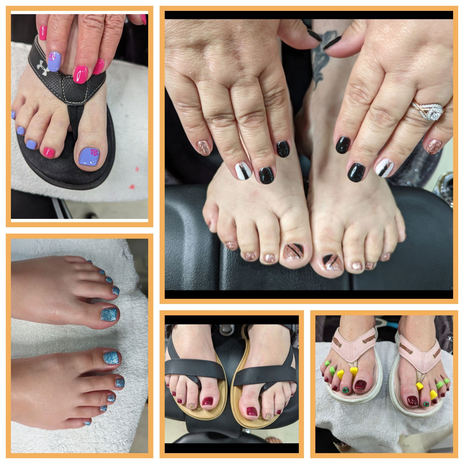 A collage of images of a woman 's feet and nails