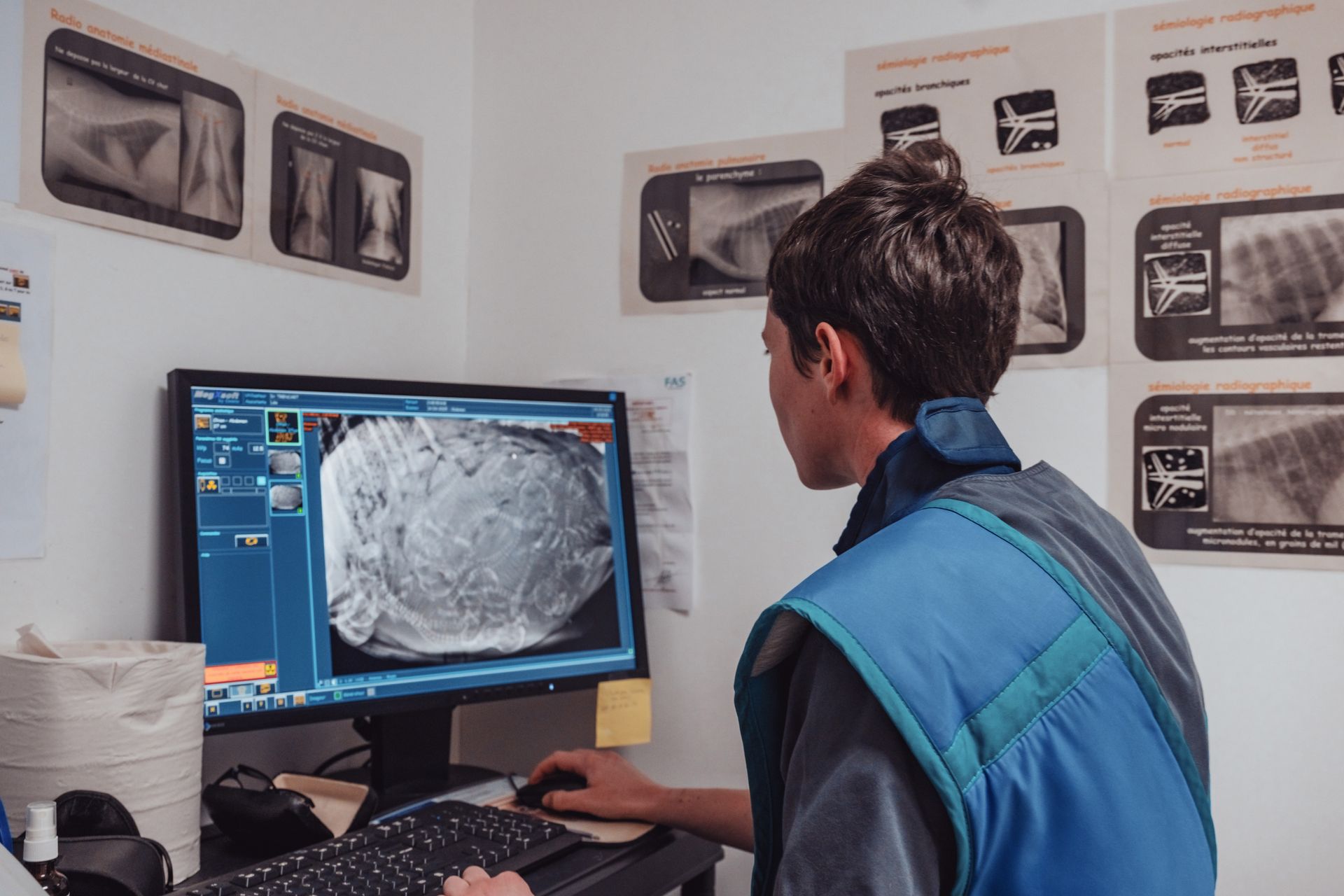 Une personne vêtue d'un gilet bleu regarde un écran d'ordinateur affichant une radiographie. Des schémas médicaux sont accrochés au mur.