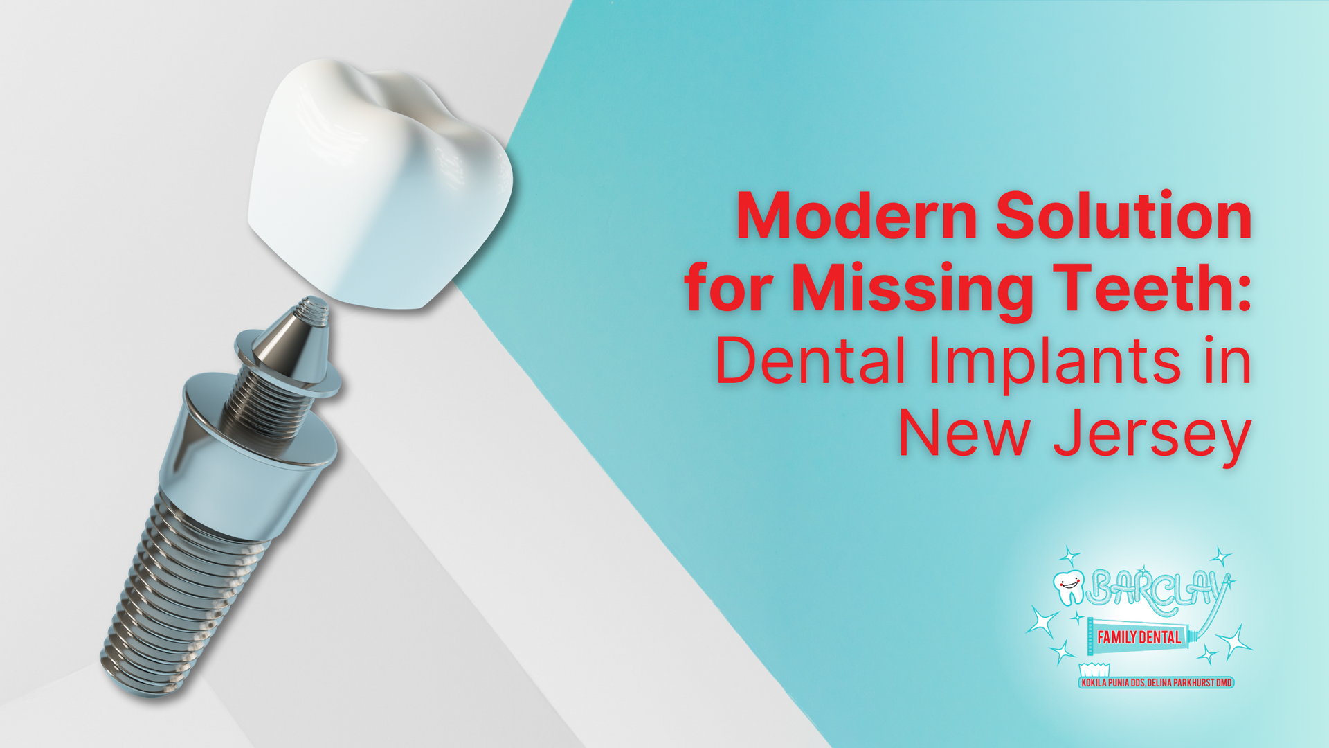 Modern solution for missing teeth : dental implants in new jersey