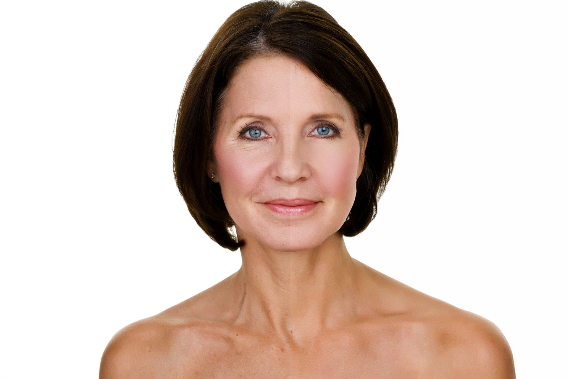 Face Lift Before and After – Danvers, MA – North Shore Facial Plastic Surgery
