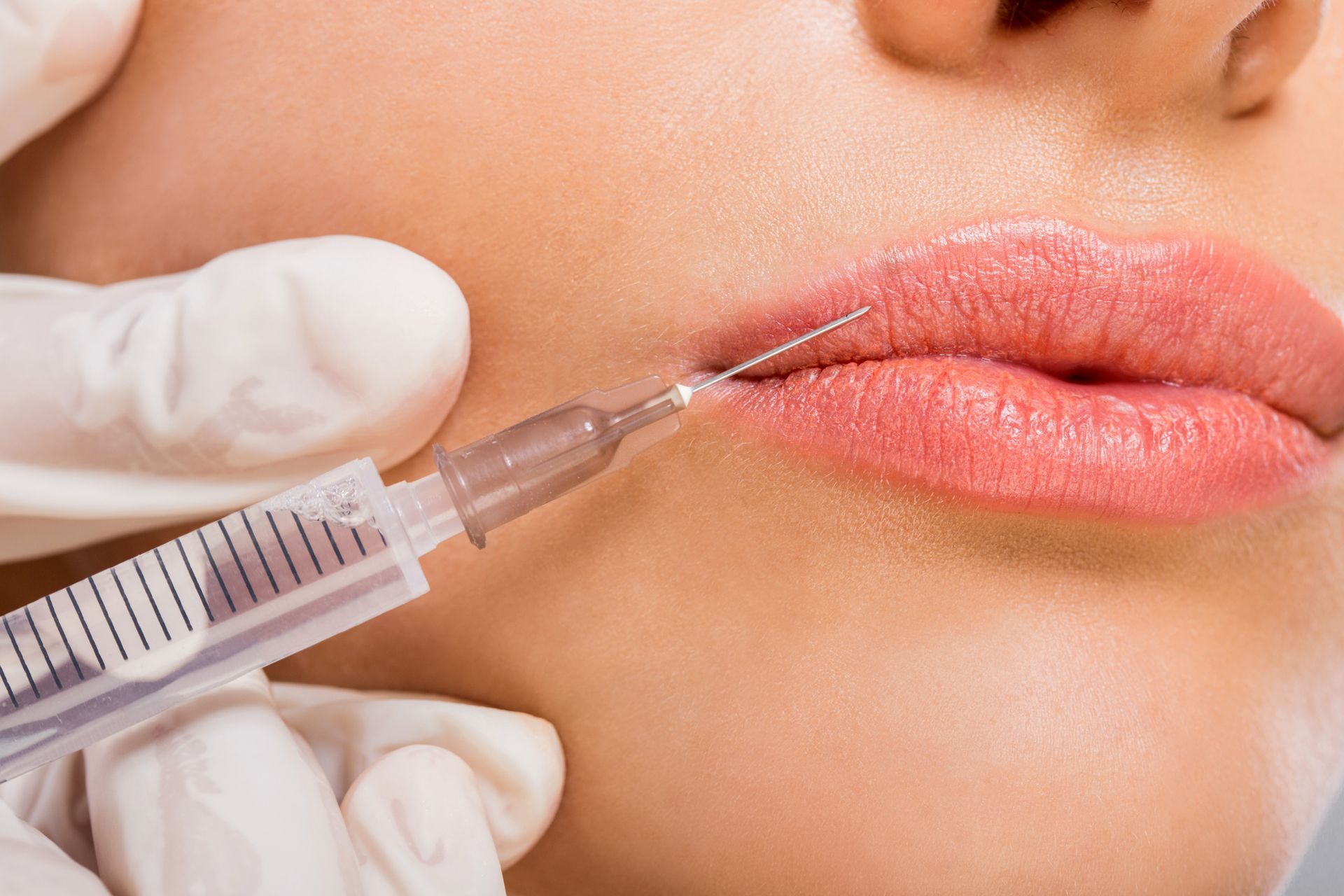 Facial Filler Treatment – Danvers, MA – North Shore Facial Plastic Surgery