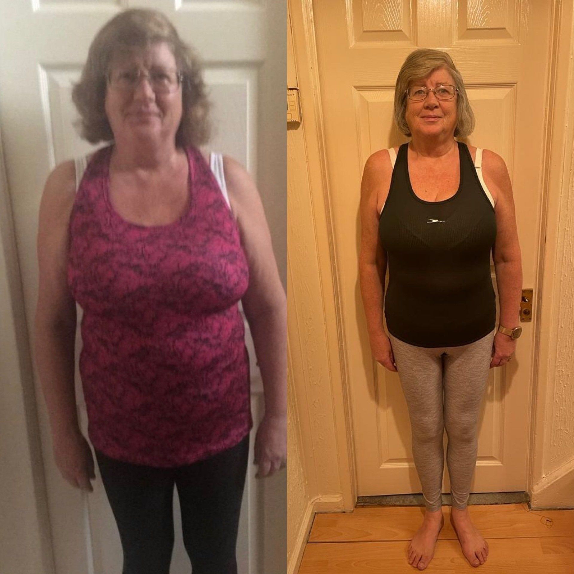 before after gallery image