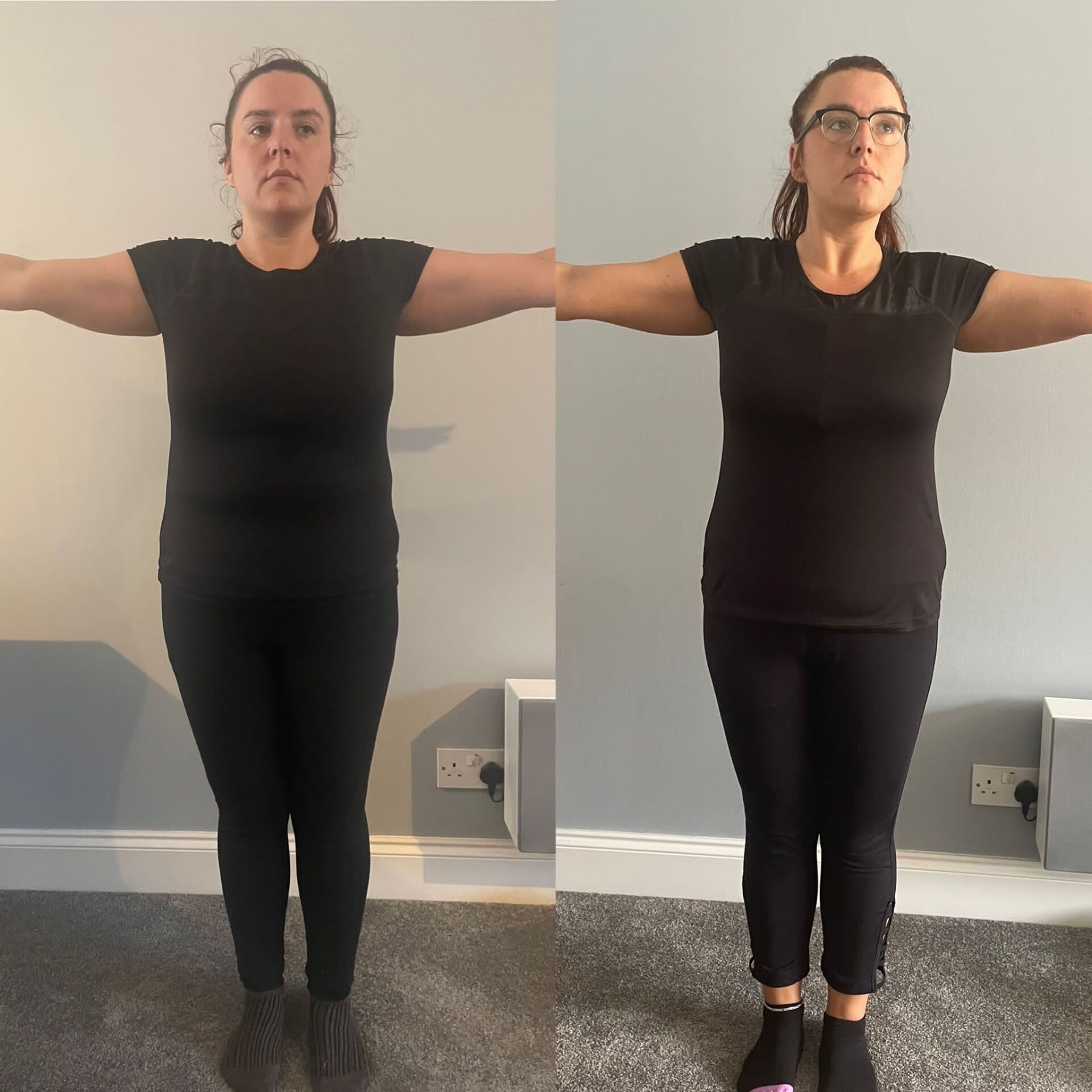 before after gallery image