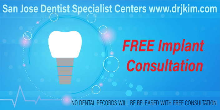 Dental Implant Free Consultation