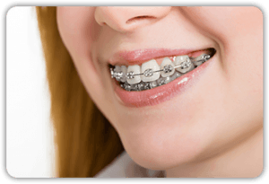 Woman With Braces
