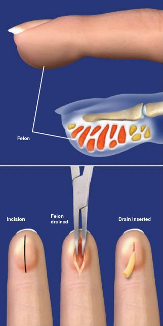 Archway Orthopedics Archway Orthopedics