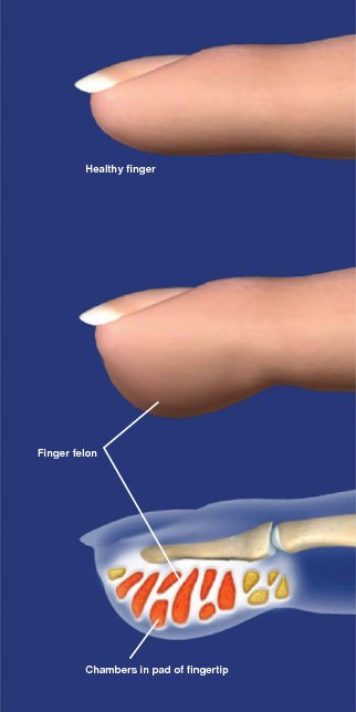 Finger Pain Treatment | When to See a Doctor for Pain in Your Finger