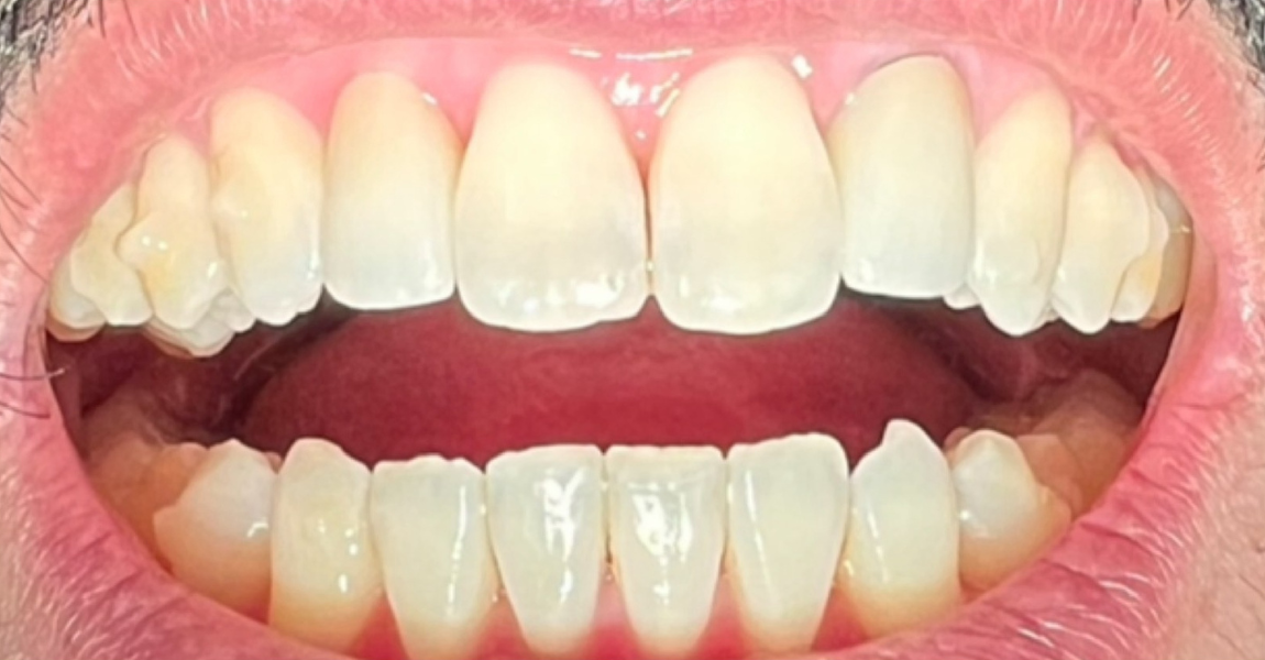 A close up of a woman 's smile with white teeth and red lips.