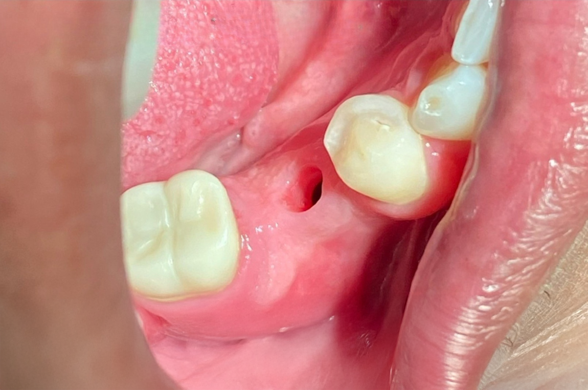A close up of a person 's teeth and mouth.