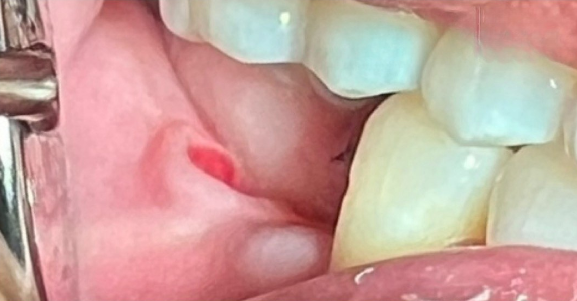A close up of a person 's mouth with white teeth.