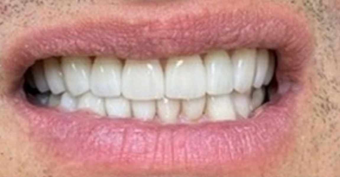 A close up of a man 's face with a beard and a smile.