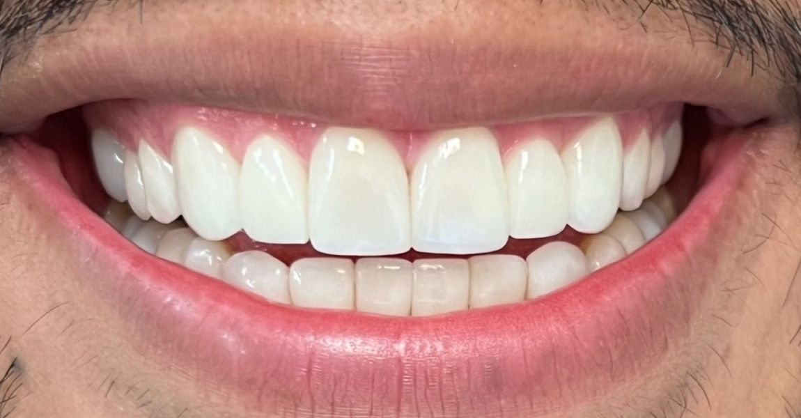 A close up of a man 's face with a beard and a smile.