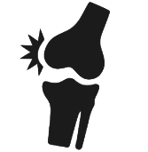 Kidney stone, urinary stone, ureteric stone, renal calculi, renal colic, nephrolithiasis
