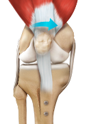 A close up of a knee with a blue arrow pointing to the knee joint.
