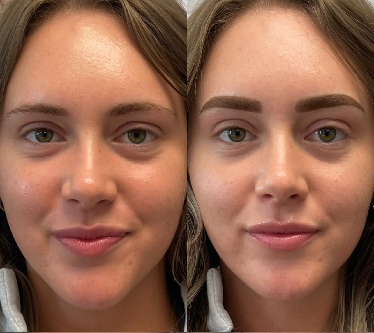 Combo Brow Before and After