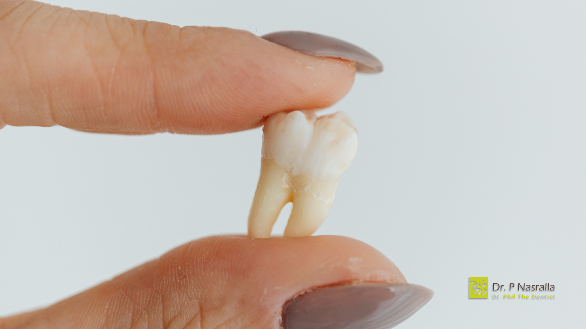 A woman is holding a tooth in her hand.