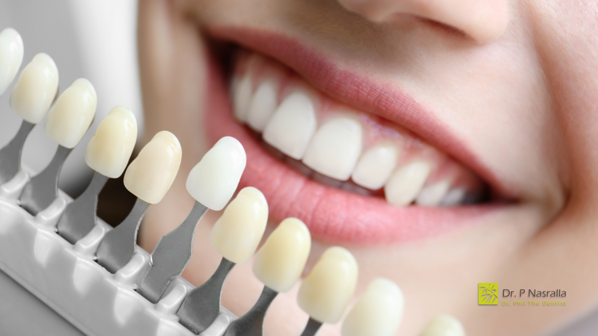 A close up of a woman 's teeth next to a tooth color chart.