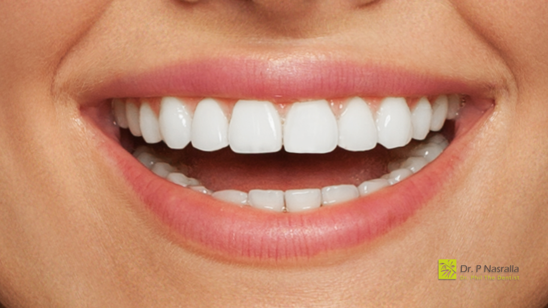 A close up of a woman 's smile with white teeth and pink lips.