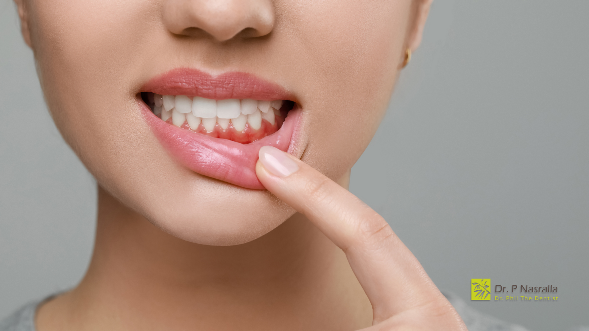 A woman is pointing at her teeth with her finger.