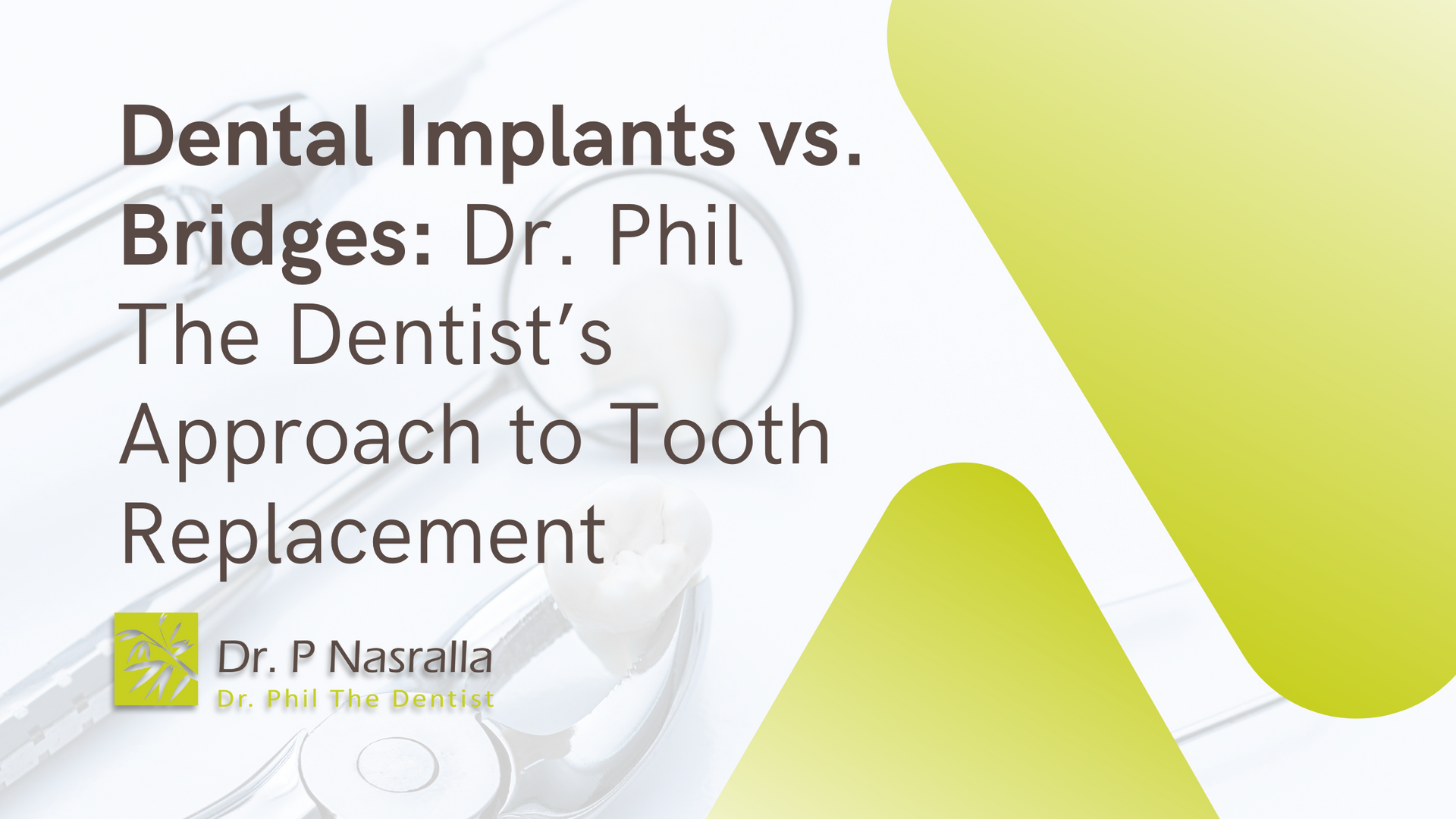 Dental implants vs. bridges : dr. phil the dentist 's approach to tooth replacement