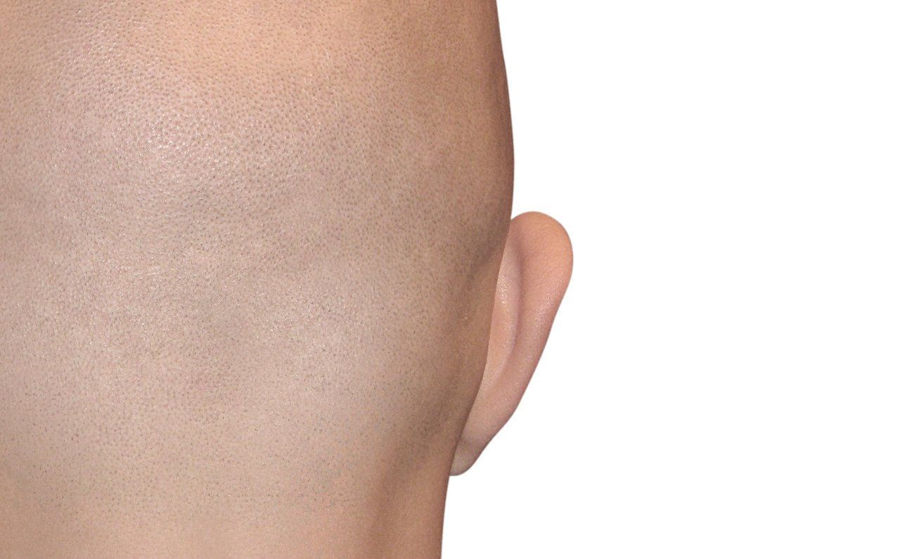 back of head and ear