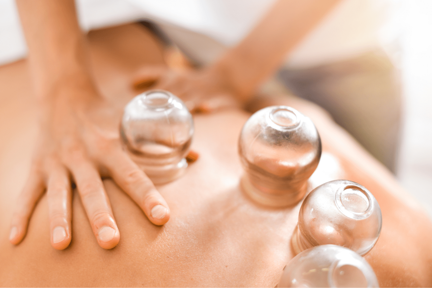 A person is getting a cupping treatment on their back.