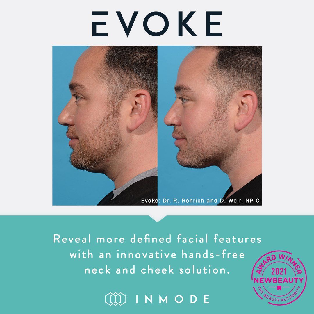 Evoke: double chin before and after
