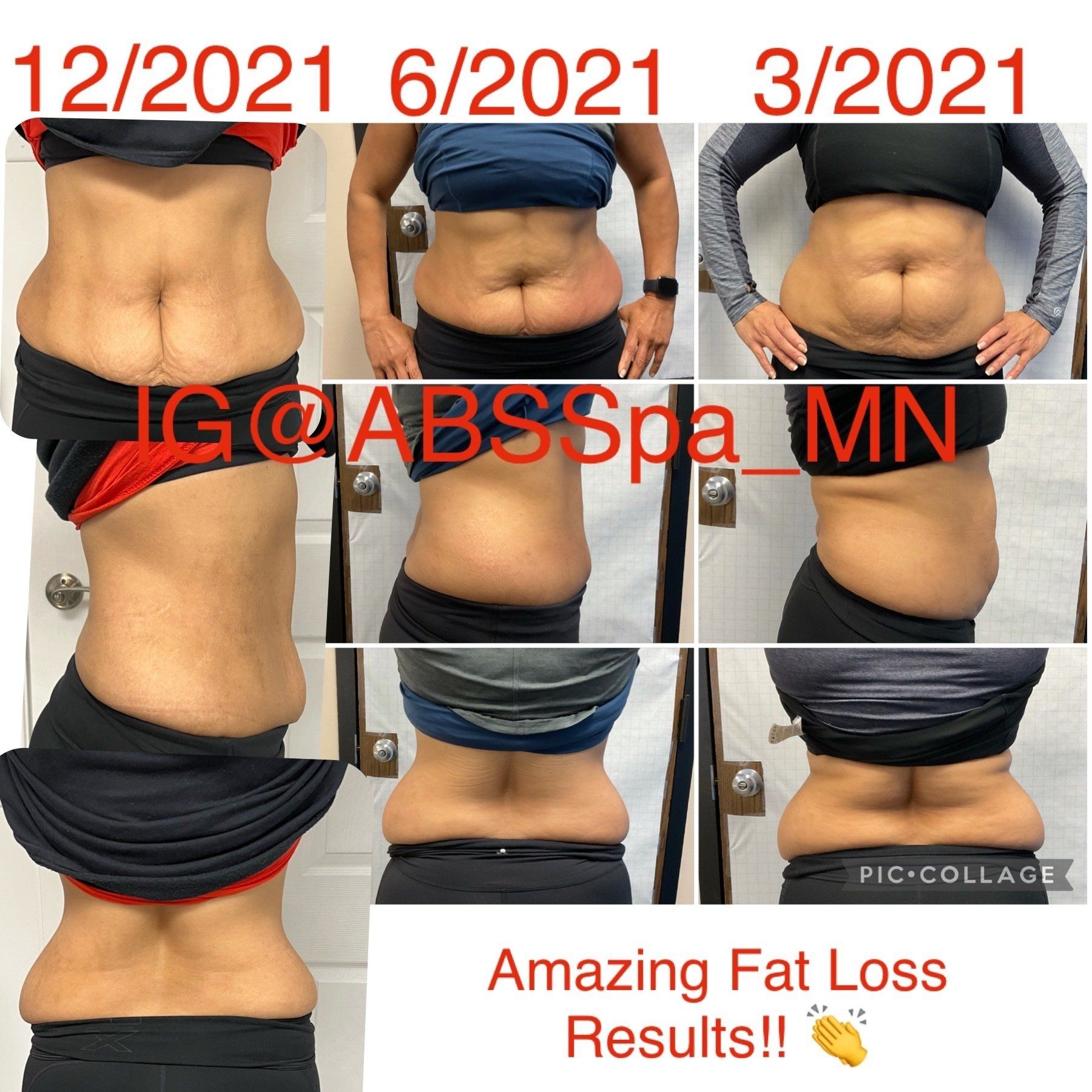 EvolveX: stomach - before and after