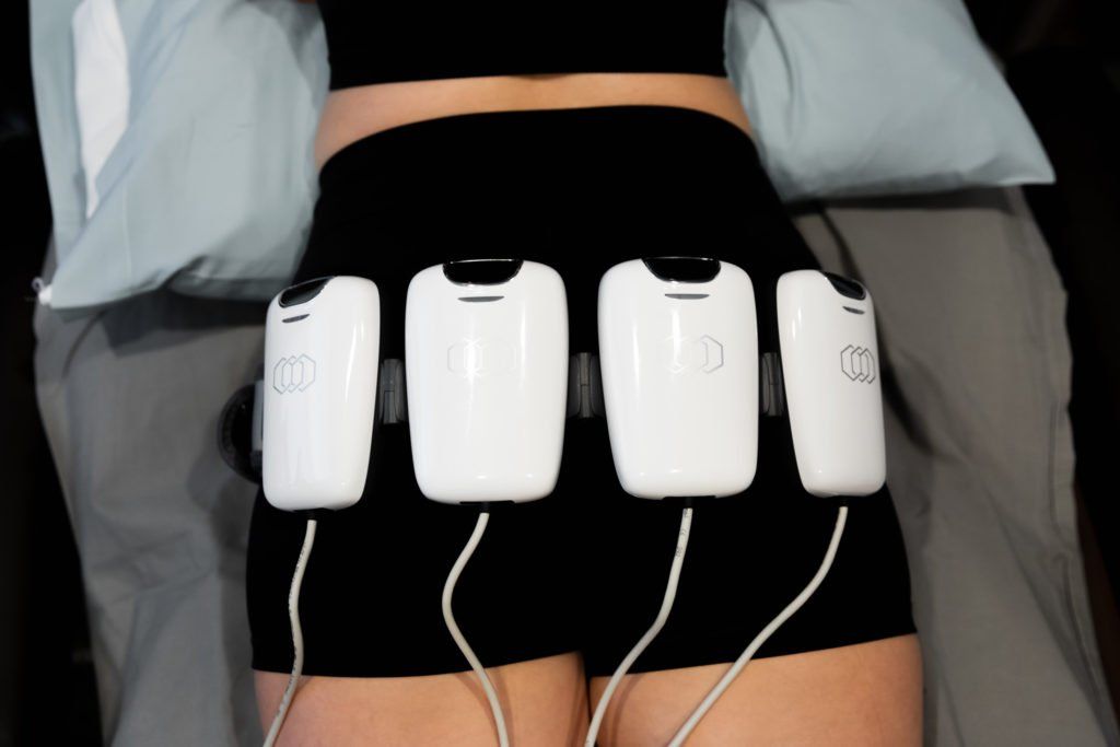 A woman is laying on a bed with a bunch of white boxes on her hips