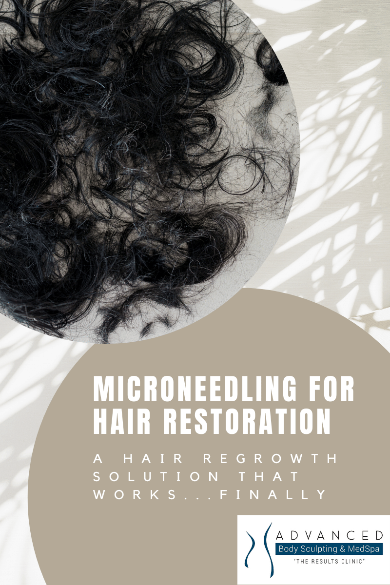 Microneedling for hair growth graphic with title and picture of hair loss