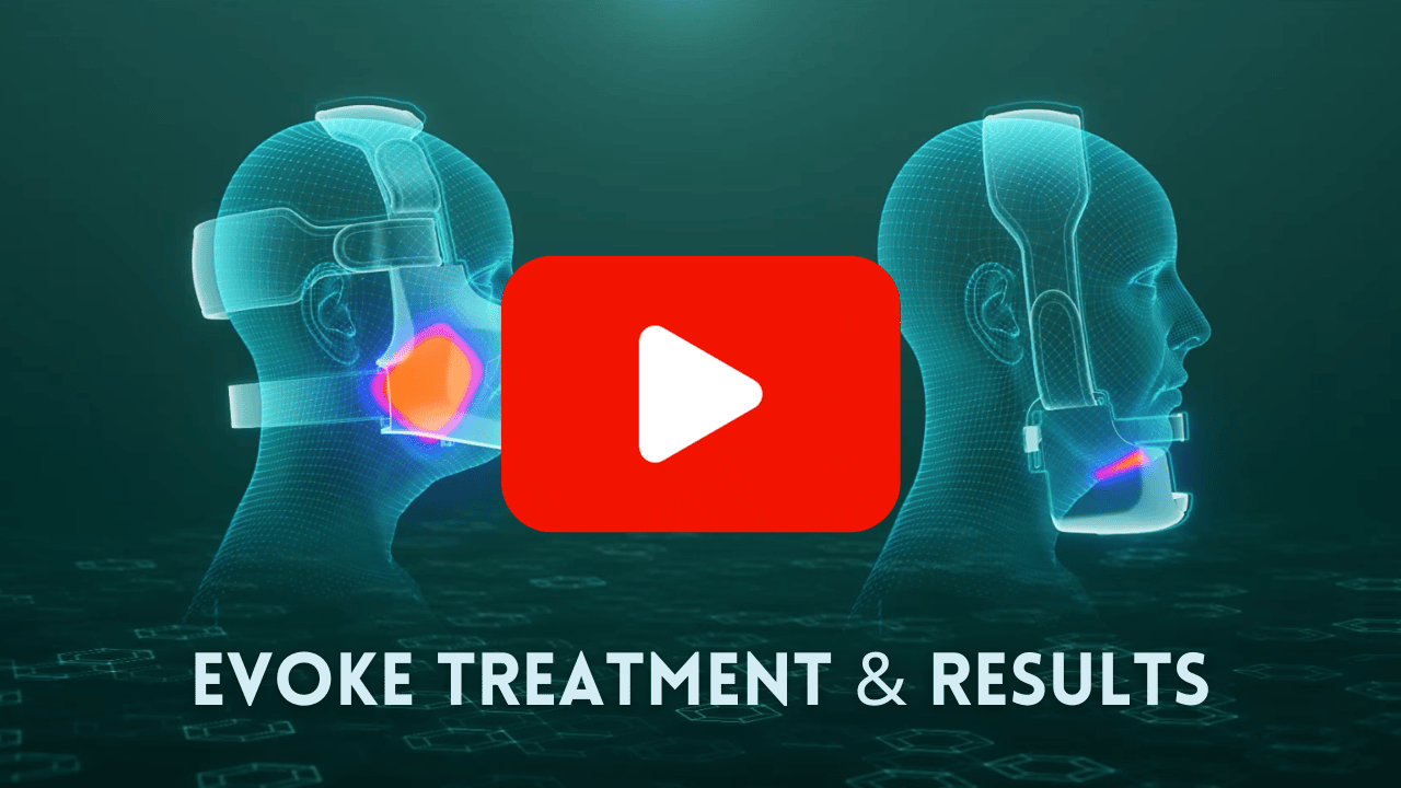 Evoke Treatment Animation Thumbnail