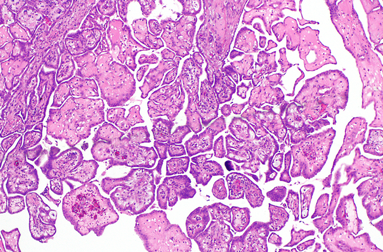 A close up of a purple and white tissue under a microscope.