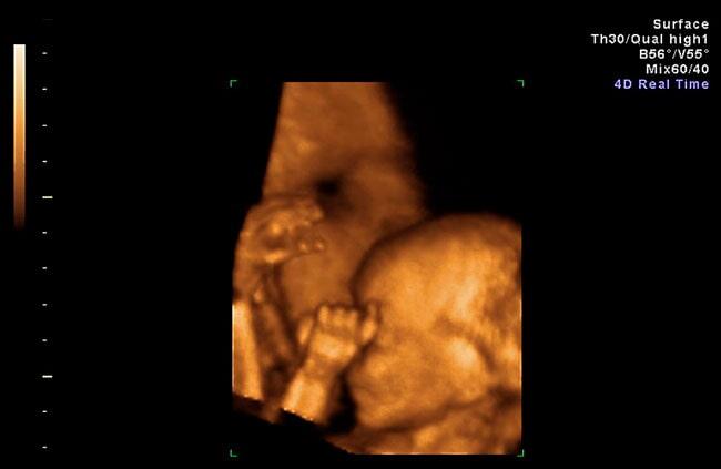 UNIDAD GINECOLÓGICA Y OBSTÉTRICA