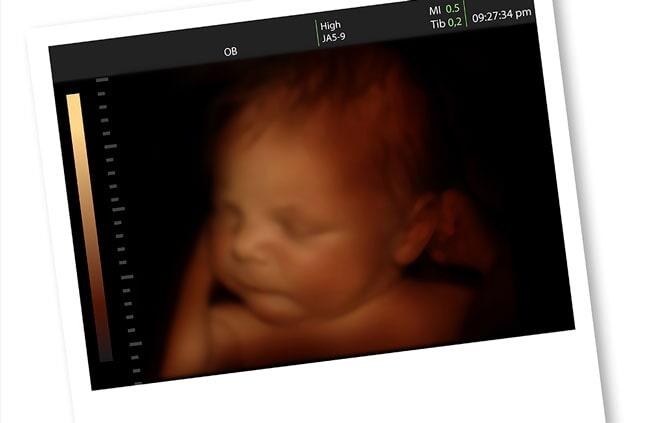 UNIDAD GINECOLÓGICA Y OBSTÉTRICA