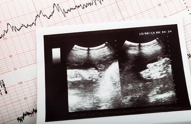 UNIDAD GINECOLÓGICA Y OBSTÉTRICA