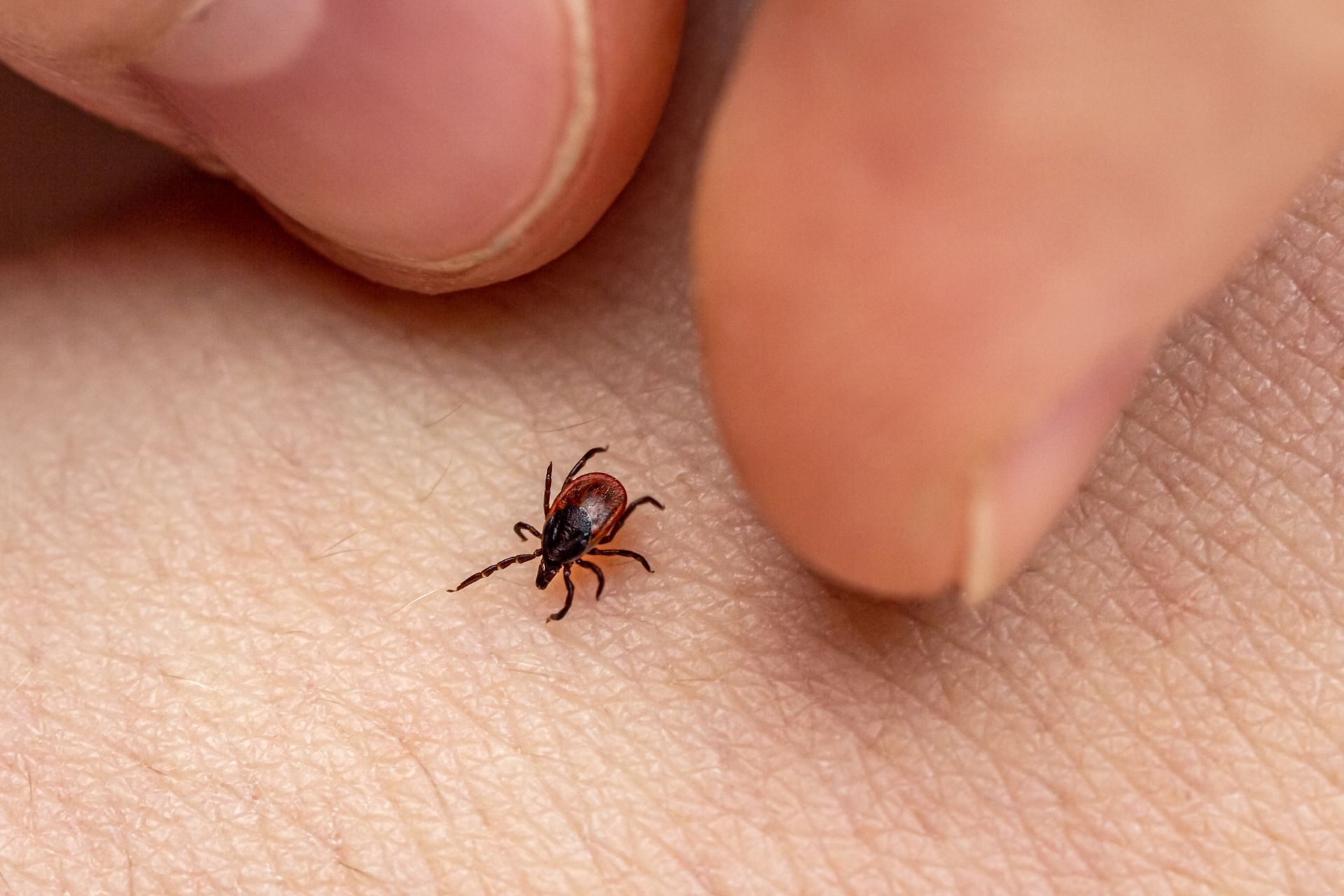 Tick on human skin, being held by two fingers, red and black body, tan skin.