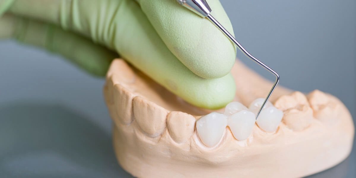 A dentist is examining a model of a person 's teeth with a dental probe.