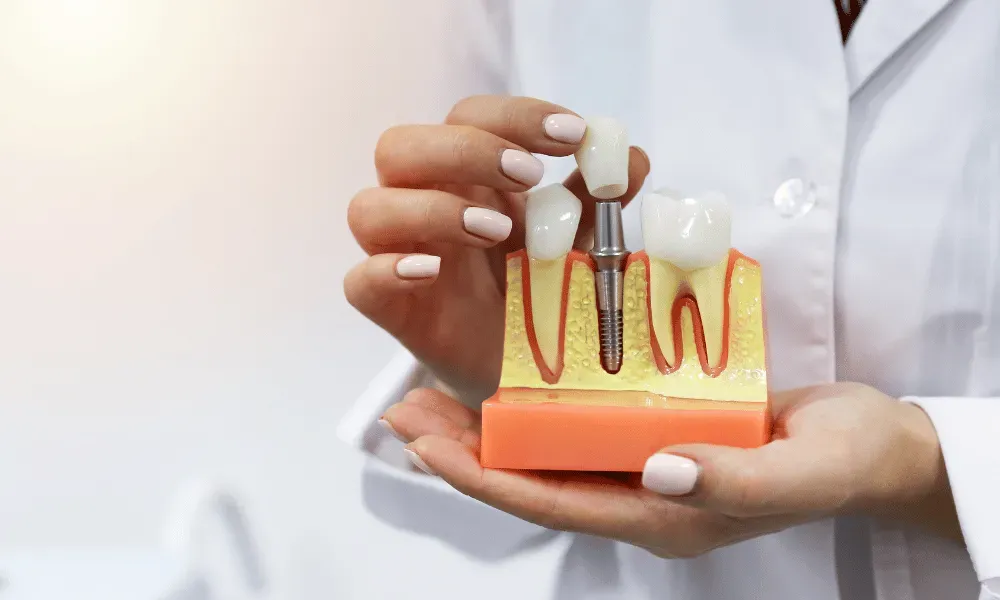A dentist is holding a model of a dental implant in her hands.