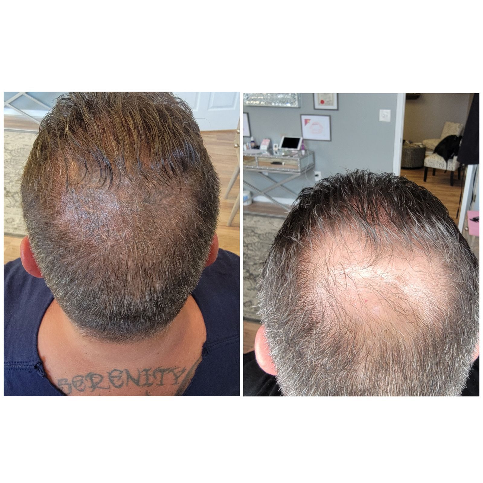 A man with a tattoo on his neck has a before and after picture of his hair.