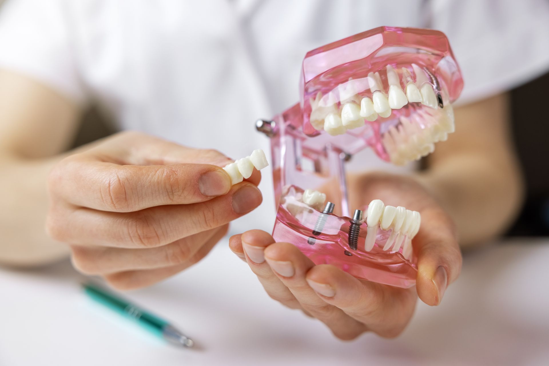 Hands holding a dental model with teeth and braces, demonstrating orthodontic treatment.