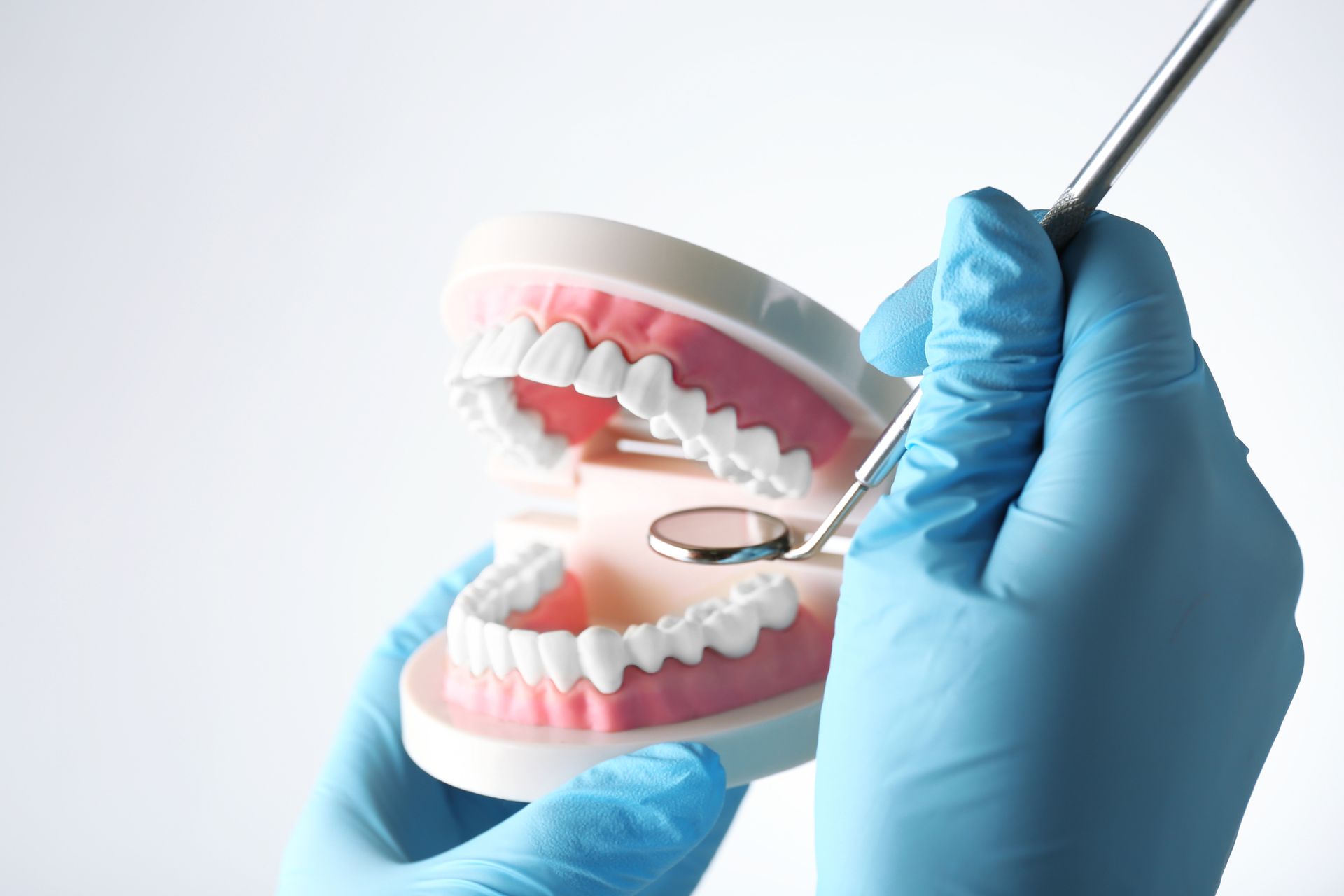 The Role of Snap-In Dentures in Preventing Bone Loss