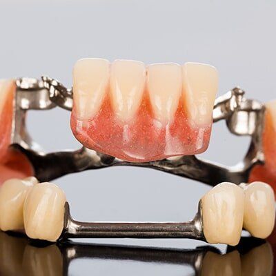 Partial Denture — Dentures And Mouthguards In Erina, NSW