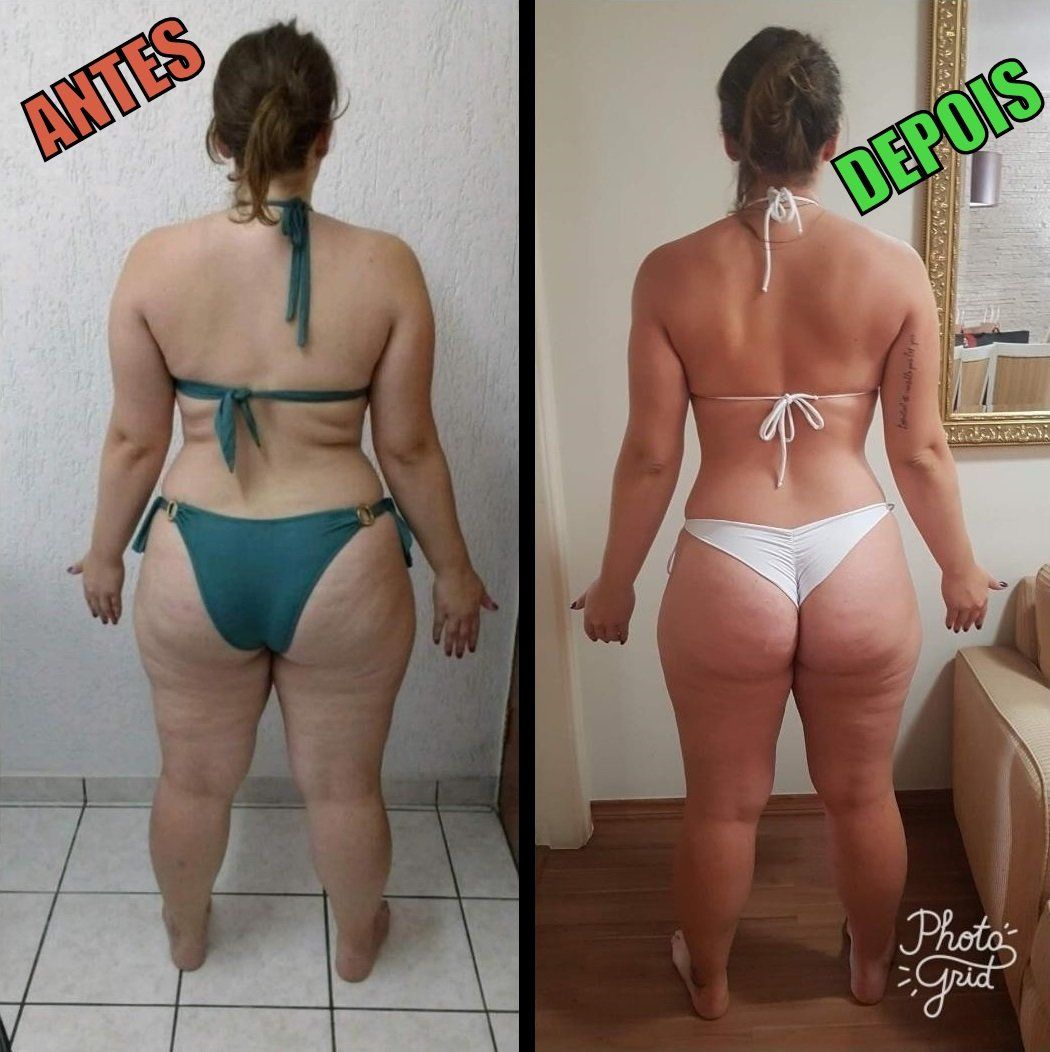 Nutricionista para Emagrecimento