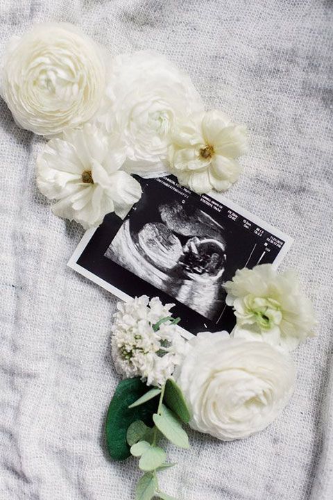 Femme Ginecología- ultrasonido